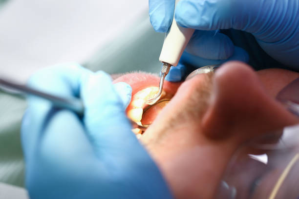 Best Tooth Infection Emergency Dentist  in Batesburg Leesville, SC